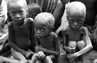 There are Starving Kids in Africa